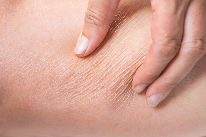 Сухата кожа и нашето здраве