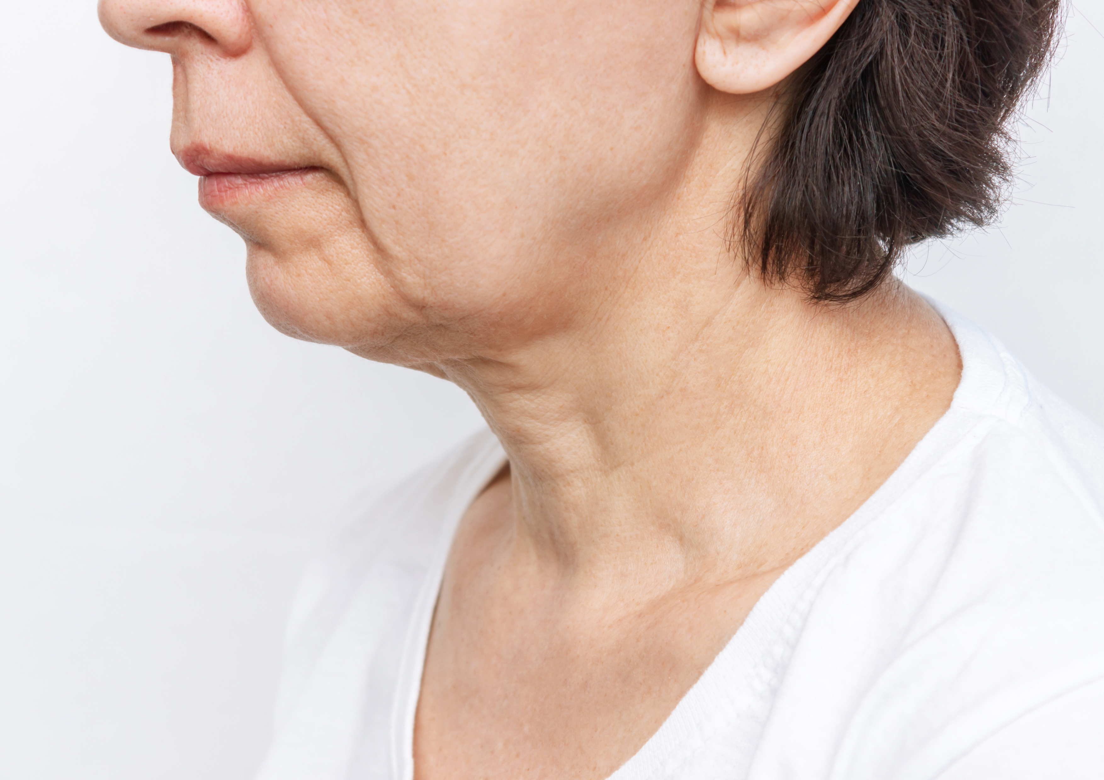 Терапия на мимическото стареене