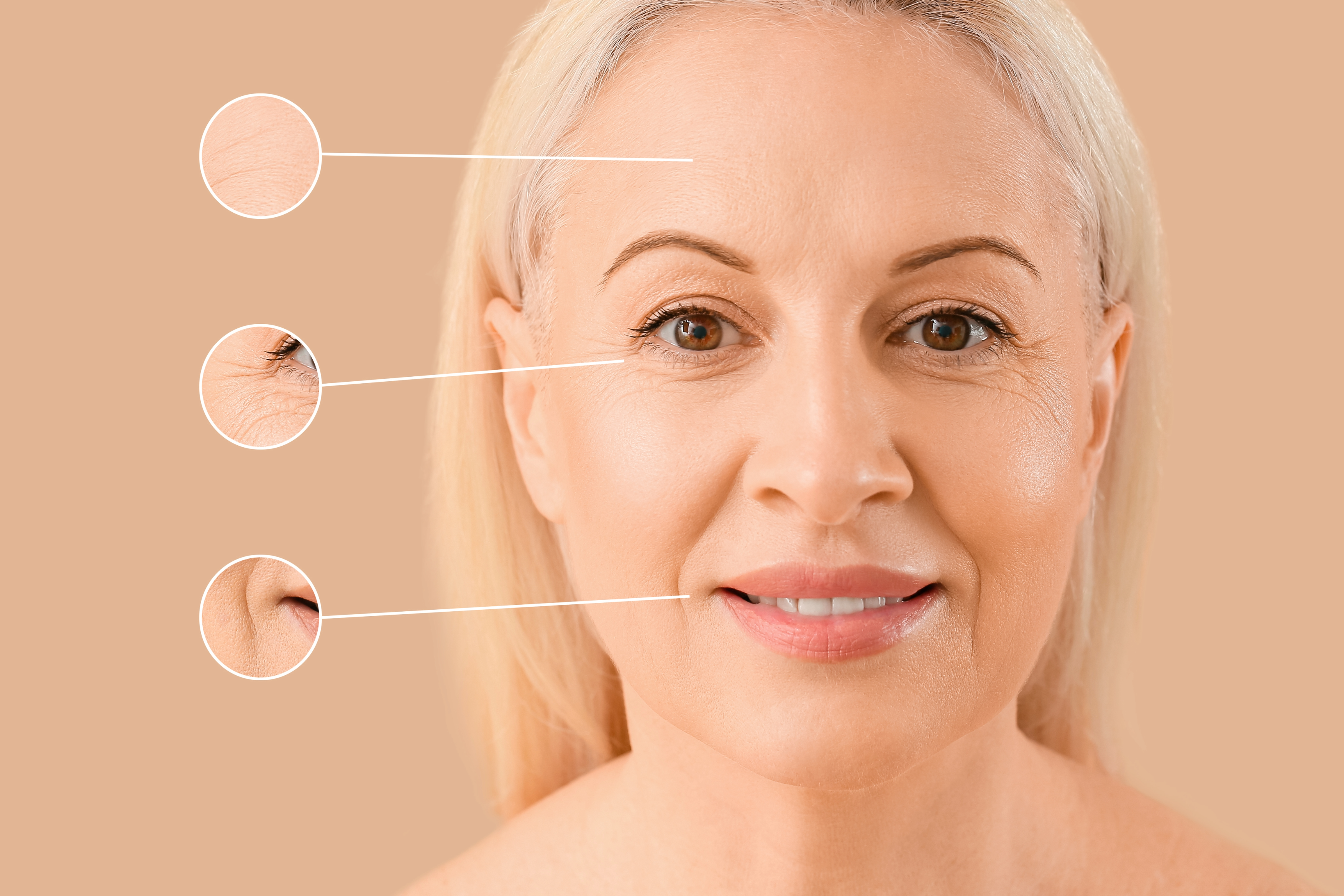 Корекция с филъри