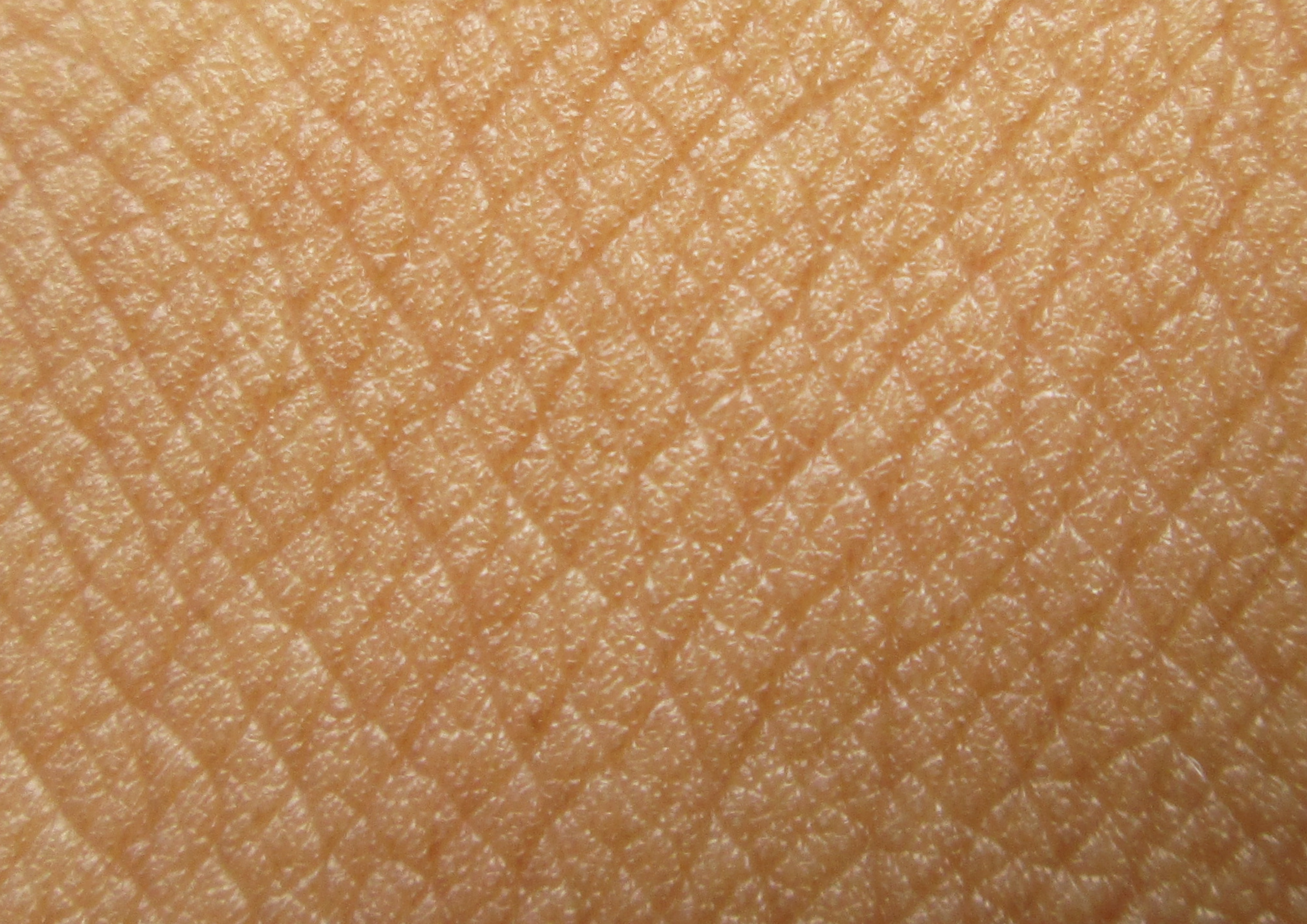 Епидермална бариера